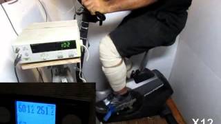 487 Watts At 170 RPM Cycling Cadence At The Highest Resistant Setting